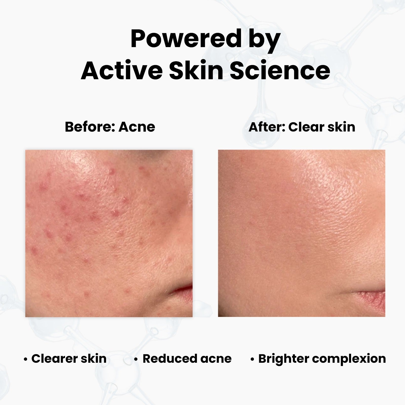Unik Naturals Daily Defense Duo – Face Cleanser + Sunscreen (Acne Control & Sun Protection)