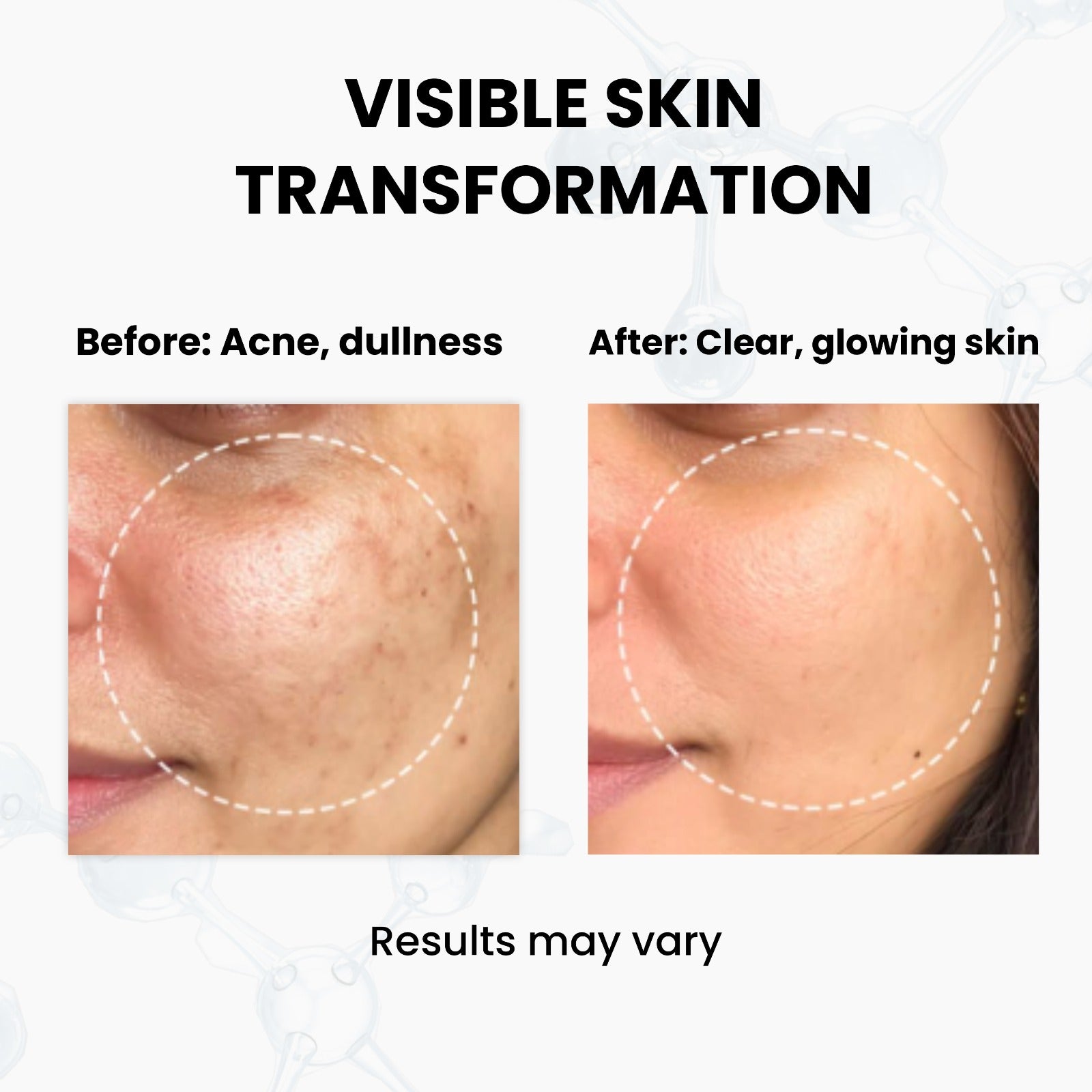 Unik Naturals Skin Clarifying Duo – Face Serum + Sunscreen (Acne Control & Protection)
